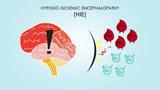 HypoxicIschemic Encephalopathy About Treatments amp Causes [upl. by Lamp]