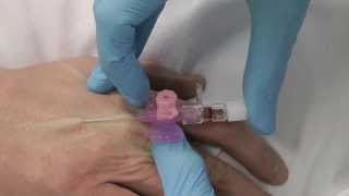 Cannulation How to gain IV access [upl. by Brig642]