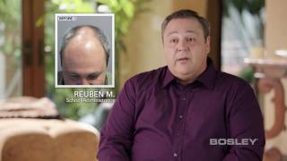 Bosley Hair Transplant Patient Review  Reuben M [upl. by Otreblig287]