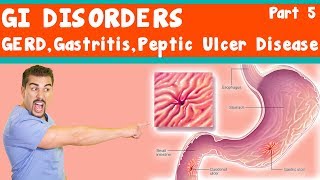 GI Disorders GERD Gastritis peptic ulcer Disease Part 5 [upl. by Ivatts]