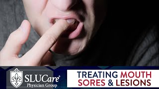 Mouth Sores amp Lesions Diagnosing and Treatment  SLUCare Otolaryngology [upl. by Atarman637]