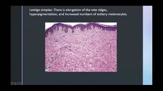 Benign pigmented and melanocytic lesions [upl. by Gaye728]