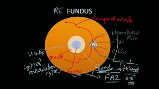 Ultrasound of Retinal vs Vitreous Detachment [upl. by Marx791]