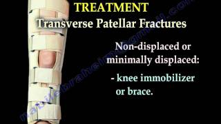 Patellar Fractures  Everything You Need To Know  Dr Nabil Ebraheim [upl. by Nakhsa]