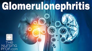 Renal Emergencies Glomerulonephritis [upl. by Saihttam902]