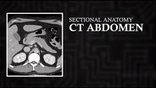 CT Cross Sectional Anatomy Abdomen Axial View [upl. by Hulen]