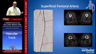 Lower Extremity Anatomy Charudatta Bavare MD [upl. by Searby619]