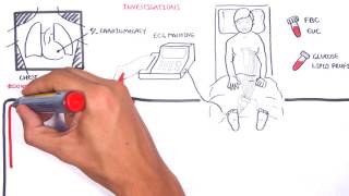 Case Study 8 Pulmonary Embolism [upl. by Lanam906]