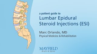 Lumbar Epidural Steroid Injections [upl. by Eizzo]