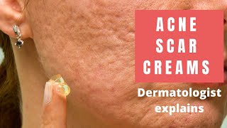 Acne Scar Creams  Dermatologist Reviews [upl. by Adamski566]