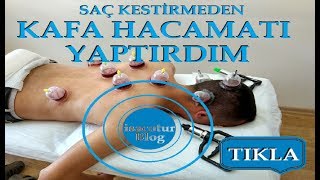 ⭐️Saç Kesmeden Kafa Hacamatı Yaptırdım ✅Kafa Hacamatı Nasıl Yapılır [upl. by Esaj642]