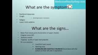 Understanding Mitral Stenosis Signs and Symptoms [upl. by Asaeret344]