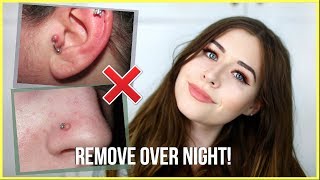 How To Get Rid Of Piercing Bumps OVERNIGHT [upl. by Inalaehon]