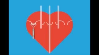 Atrial Rhythms  EKG Interpretation  LevelUpRN [upl. by Temme]