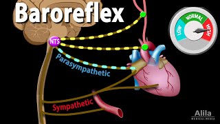 Autonomic Dysreflexia Hyperreflexia Nursing Review Symptoms Treatment [upl. by Yerac131]