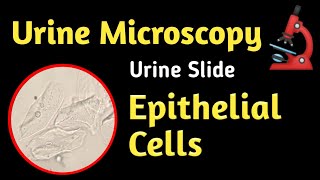 Epithelial cell in urine  Urine microscopy  Urine RE Test  Urine Complete [upl. by Ruthy]