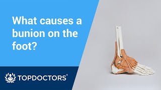 What causes bunions [upl. by Reddin]