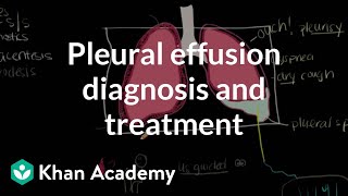 Pleural effusion diagnosis and treatment  Respiratory system diseases  NCLEXRN  Khan Academy [upl. by Eniawed]