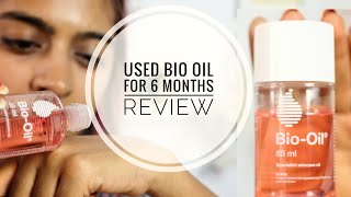 Bio Oil Review  Does Bio Oil Work on Stretch Marks amp Scars  SuperWowStyle [upl. by Lanor946]