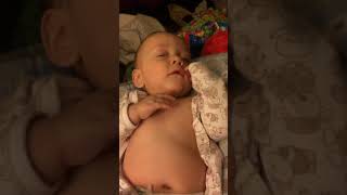 Example of Retractions Belly Breathing and Tachypnea in Infant [upl. by Glenine]