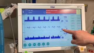 Module 3 Respiratory System and mechanical ventilation  Part 1 [upl. by Aivun]