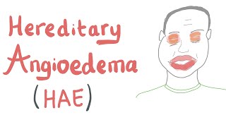 Hereditary Angioedema HAE [upl. by Fernando]