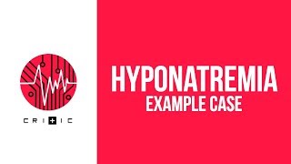 Hyponatremia  An example case [upl. by Amiaj511]