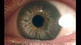 Eye Works 1 Focusing Cornea Iris and Lens [upl. by Seymour]