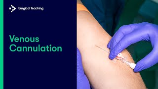 Intravenous IV Cannulation  An Essential Guide [upl. by Chapa]