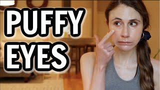 How to get rid of puffy eyes Dr Dray [upl. by Ttayh]