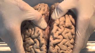 Introduction Neuroanatomy Video Lab  Brain Dissections [upl. by Gut]