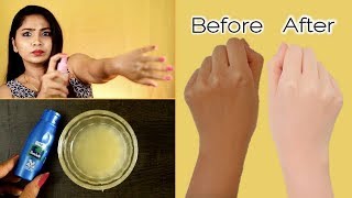 Simple Full Body Whitening Formula Easy amp 100 Effective  Rabia Skincare [upl. by Duyne]