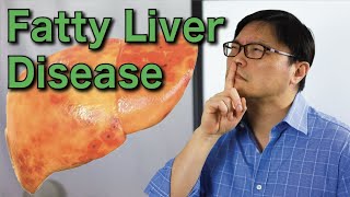 How to Reverse Fatty Liver Disease Naturally  Jason Fung [upl. by Latoye]