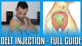 How To Do A Deltoid Injection  Full GuideDemo [upl. by Antonina]