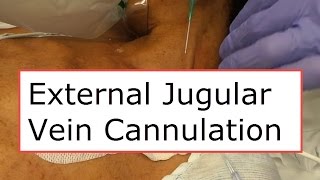 External Jugular Vein Cannulation [upl. by Eisen904]