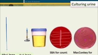 Urine Culture How To Interpret Count [upl. by Nicholle]