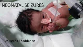 Neonatal Seizures  Pediatrics [upl. by Florentia]