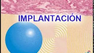 implantacion [upl. by Valina]