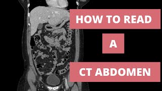 How to read a CT Abdomen for Med students and Residents  Part 1 [upl. by Terza]