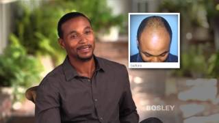 Bosley Hair Restoration Patient Review  Gerald R [upl. by Enahs225]