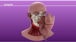 Face transplant recipients mom learns about renowned reconstructive surgeon 2020 Nov 16 Part 2 [upl. by Elletse]