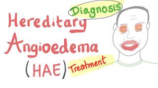 Update of Classification Diagnosis and Treatment of Hereditary Angioedema HAE [upl. by Hamil214]