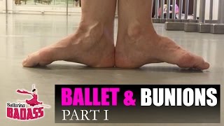 Ballet amp Bunions Part I How To Stretch Strengthen amp Prevent Pain with Ballerina Badass [upl. by Llebasi]