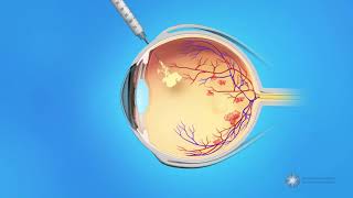 High Yield Topic  Clinical Anatomy of Retina [upl. by Odraode986]