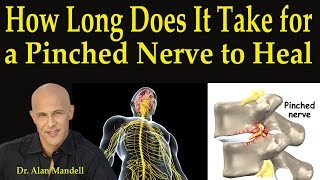 How Long Does It Take For A Pinched Nerve to Heal  Dr Mandell [upl. by Uokes]