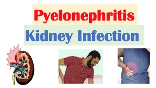 Pyelonephritis Kidney Infection  Causes Pathophysiology Signs amp Symptoms Diagnosis Treatment [upl. by Soiritos772]