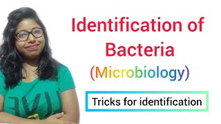 Identification of Bacteria MICROBIOLOGY [upl. by Molli373]