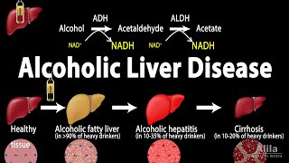 Alcoholic Liver Disease Animation [upl. by Tabor412]