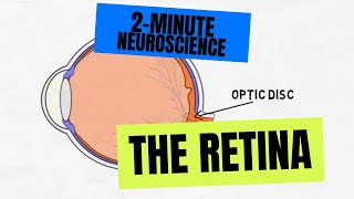 Detached Retina after Cataract Surgery [upl. by Caiaphas76]