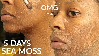 I Used SEA MOSS GEL on My FACE for 5 Days amp WOW [upl. by Aeet990]